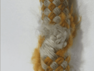 revision epi revision epi